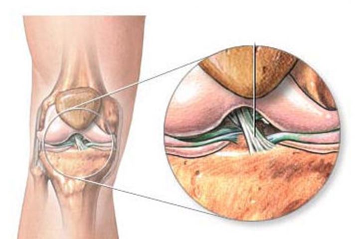 Anatomische Darstellung des vorderen Kreuzbands.